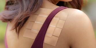  Przylepiec Viscoplast™ przyklejony na ramieniu
