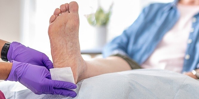 Opatrunek Viscoplast nakładany na piętę
