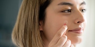 Plastry Viscoplast™ Acne Patch
